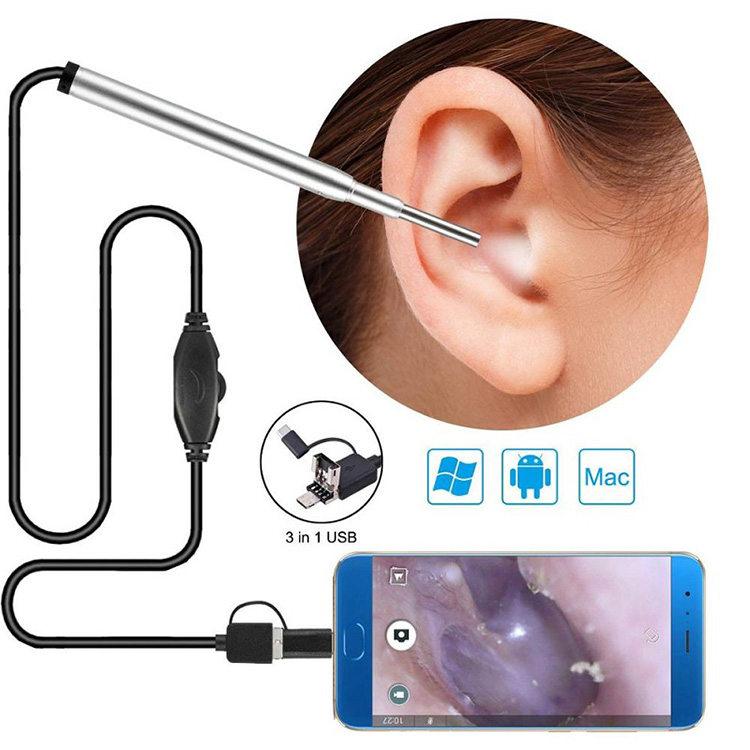 ການແພດ Endoscope ກ້ອງຫູ Nasal Endoscope Usb Otoscope